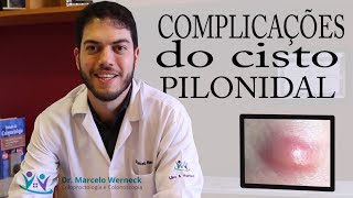 Complicações do cisto pilonidal  Dr Marcelo Werneck [upl. by Namhcan]