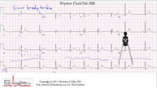 ECG Interpretation Tutorial  ChalkTalk 08  Basic Level [upl. by Eninahpets888]