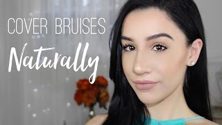 How to Cover Bruises Naturally with Makeup [upl. by Lancey370]