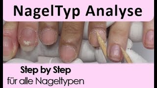 Nagelmodellage  Nagel Typ Analyse [upl. by Samuel146]