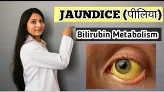 Jaundice in Hindi  Differential Diagnosis Of Jaundice PrehepaticIntrahepaticPosthepaticPART 2 [upl. by Irtemed]