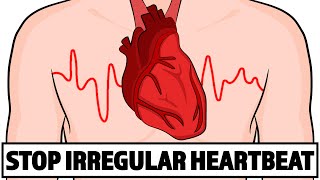 How to Fix your Irregular Heartbeat in Under 3 minutes [upl. by Hey]