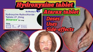 Atarax tablet Hydroxyzine  Hydroxyzine hydrochloride  Atarax 25 mg  Hicope 25 tablet [upl. by Reeta]