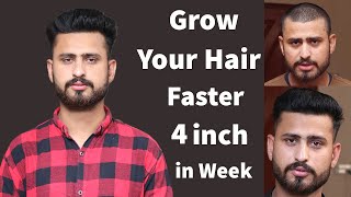 How To Grow Your Hair Faster And Longer Naturally At Home  Grow Your Hair Fast 4 Inch In A Week [upl. by Sawyer]