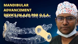 Dr Rudraखर्राटों को रोकने के लिए उपकरण  MANDIBULAR ADVANCEMENT DEVICE FOR OBSTRUCTIVE SLEEP APNEA [upl. by Etnod899]