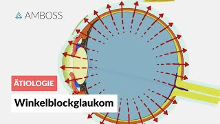 Akutes Winkelblockglaukom bei Pupillarblock  AMBOSS Video [upl. by Ailemor523]