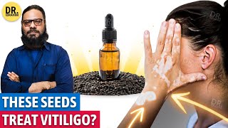 quotBabchiquot Se quotBarsquot Ka Ilaj Bakuchi Seeds Oil for Vitiligo  Dr Ibrahim [upl. by Wenoa]