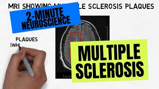 2Minute Neuroscience Multiple Sclerosis [upl. by Akkahs]