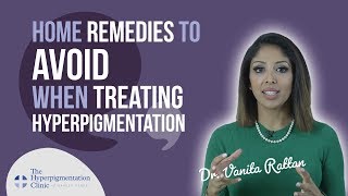 How to Treat Hyperpigmentation  Home Remedies  DO THEY WORK [upl. by Linnette]