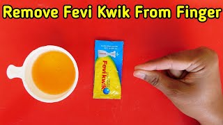 How To Remove Feviquick From Hand Feviquick Remover From Hand [upl. by Hasin]