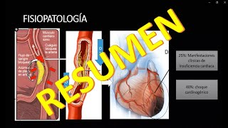 INFARTO AGUDO AL MIOCARDIO IAM FISIOPATOLOGIA [upl. by Meldoh]