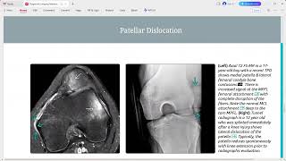 PAEDS RADIOLOGY DIAGNOSTIC IMAGING SERIES [upl. by Lisab558]