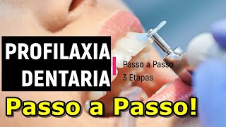 TUDO SOBRE PROFILAXIA DENTÁRIA  O QUE É DO QUE PRECISA COMO FAZ  PASSO A PASSO DA PROFILAXIA [upl. by Slohcin]