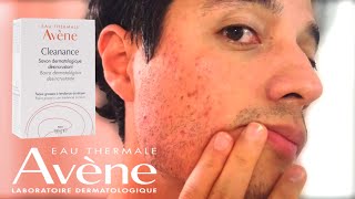 Barra Eau thermale Avene  Cleanance  Barra dermatológica desincrustante para acné reseña  review [upl. by Eisned]