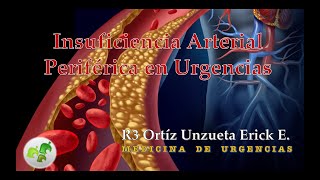 Insuficiencia Arterial Periférica [upl. by Etiuqal993]