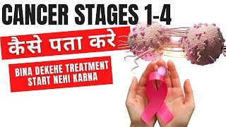 Cancer stages 14 in Hindi  Cancer stages explained [upl. by Eillehs]