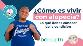 Shawn Pastrana comparte su experiencia con la ALOPECIA [upl. by Hardi]