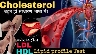 Cholesterol lipid profile testLDLHDL in Hindiby DOCTORLab [upl. by Yorel]