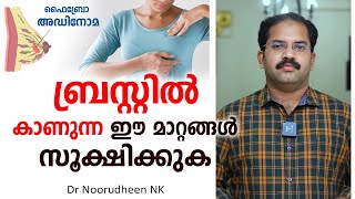 ബ്രസ്റ്റിൽ കാണുന്ന ഈ മാറ്റങ്ങൾ സൂക്ഷിക്കുക  Fibroadenoma  Dr Noorudheen NK [upl. by Georgy]