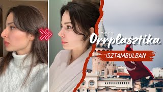 ORRMŰTÉT VLOG Isztambulban  Esteworld [upl. by Israel]