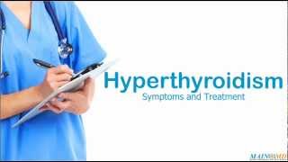 Hyperthyroidism ¦ Treatment and Symptoms [upl. by Akinohs]