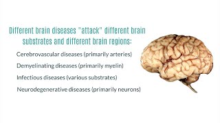 Neuroradiology of stroke  Radiology [upl. by Deevan333]