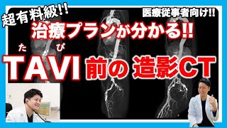 TAVI治療プラン 造影CTの威力 TAVI（Transcatheter Aortic Valve Implantation の穿刺部位、人工弁の選択 上嶋亮先生 かみじま内科クリニック [upl. by Borden]