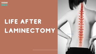 Life After Laminectomy [upl. by Weywadt]