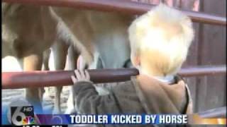 Toddler survives horse kick to face [upl. by Tarah]