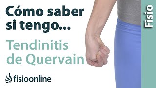 Cómo saber si tienes TENDINITIS de QUERVAIN o tendinitis del pulgar [upl. by Denney379]