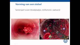 Hemostase deel 1 Inleiding  Prof dr REG Schutgens [upl. by Zucker]