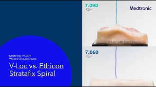 VLoc™ Device Suture Strength versus Stratafix™  Clip 2 [upl. by Chelsea117]