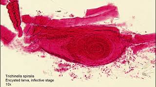 Trichinella spiralisEncysted larva [upl. by Lebanna]