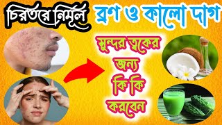 mukher brono dur korar upay kiব্রণ কালো দাগ কমানোর উপায়🥰 [upl. by Torrey]