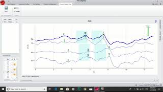 Moving ABR traces on MIRA download software [upl. by Mcafee89]