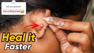 How to Heal Ear Piercing fast QnA Ravina Gupta [upl. by Biamonte292]