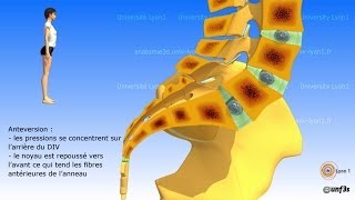 Vidéo sonorisée Placement du bassin  charnière lombosacrée [upl. by Aninaj]