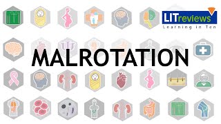 Malrotation [upl. by Dyun]