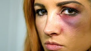 Becky Lynch learns she cant compete at Survivor Series WWE The Day Of [upl. by Aneetsyrk]