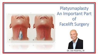 Platysmaplasty A most Important Part of a Facelift [upl. by Kemp]