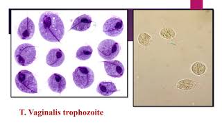 Practical Trichomonas [upl. by Irisa415]