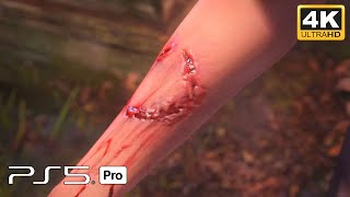 The Last Of Us Part I  Young Ellie Got Bitten 4K60FPSRT PS5 Pro Enhanced Gameplay [upl. by Neeruan]