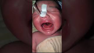 new born baby loudly crying 😭 all hospital doctor and nursing worries [upl. by Elocen]