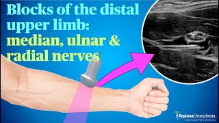 Ultrasound guided blocks of the median ulnar and radial nerves [upl. by Bartolome316]