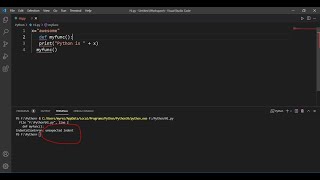 IndentationError unexpected indent Problem Solve Python VSCODE [upl. by Ailaham2]