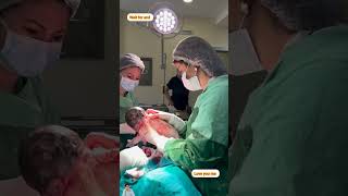 CSECTION delivery viralvideo hospital shortvideo youtube janin hospital duty mdmedical00 [upl. by Acceber212]