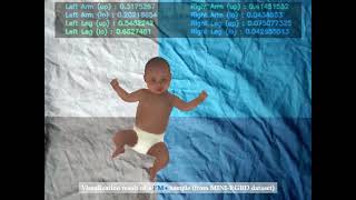 Identification of Abnormal Movements in Infants A DNN for Body Partbased Prediction of CP [upl. by Ellenehc]