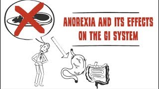 How anorexia affects the digestive system [upl. by Aysab]