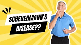 What is Scheuermanns Disease [upl. by Kittie]