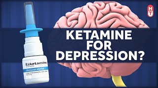 Ketamine as a Treatment for Depression [upl. by Nahej372]